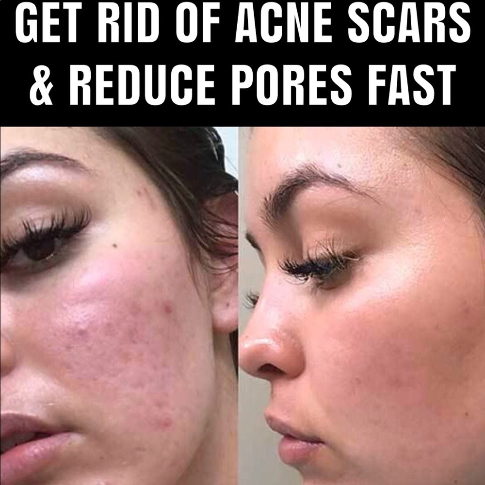 Magic Skin Repair Serum